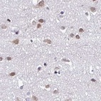 Anti-DR1 Antibody