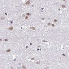 Immunohistochemical staining of human cerebral cortex using Anti-DR1 antibody HPA055308.
