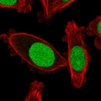 Immunofluorescent staining of human cell line PC-3 shows localization to nucleus.