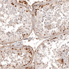 Anti-CALB2 Antibody