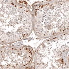 Immunohistochemical staining of human testis shows strong cytoplasmic positivity in a subset of cells in seminiferous ducts.