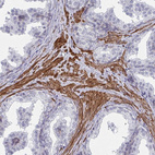 Anti-NEURL4 Antibody