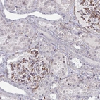 Immunohistochemical staining of human kidney shows moderate cytoplasmic positivity in cells in glomeruli.