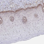 Immunohistochemical staining of human cervix, uterine shows moderate cytoplasmic positivity in squamous epithelial cells.