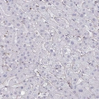 Immunohistochemical staining of human liver shows no cytoplasmic positivity in hepatocytes as expected.