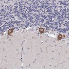 Anti-EEF1G Antibody