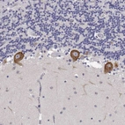 Immunohistochemical staining of human cerebellum shows strong cytoplasmic positivity in Purkinje cells.