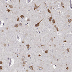 Anti-EEF1G Antibody