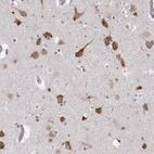Immunohistochemical staining of human cerebral cortex shows strong cytoplasmic positivity in neurons.