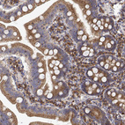 Anti-EEF1G Antibody