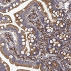 Immunohistochemical staining of human duodenum shows strong cytoplasmic positivity in glandular cells.
