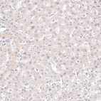 Immunohistochemical staining of human liver shows no positivity in hepatocytes as expected.