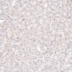 Anti-CALB2 Antibody