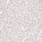 Immunohistochemical staining of human liver shows no positivity in hepatocytes as expected.