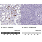 Anti-ATP6V0D2 Antibody