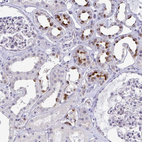 Immunohistochemical staining of human kidney shows moderate cytoplasmic positivity in cells in tubules.