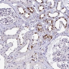 Immunohistochemical staining of human kidney shows moderate cytoplasmic positivity in cells in tubules.