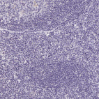 Immunohistochemical staining of human tonsil shows no positivity in germinal center and non-germinal center cells as expected.