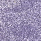 Immunohistochemical staining of human tonsil shows no positivity in germinal center and non-germinal center cells as expected.