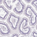 Immunohistochemical staining of human small intestine shows no positivity in glandular cells as expected.