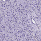 Immunohistochemical staining of human pancreas shows no positivity in exocrine glandular cells as expected.