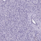 Immunohistochemical staining of human pancreas shows no positivity in exocrine glandular cells as expected.