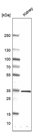 Western blot analysis in human kidney tissue.