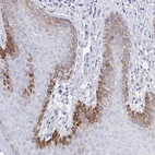 Immunohistochemical staining of human skin shows strong cytoplasmic positivity in subset of squamous epithelial cells.