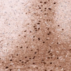 Immunohistochemical staining of mouse brain shows strong cytoplasmic positivity in a subset of neurons.