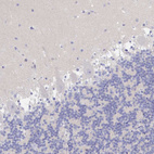 Anti-ZNF561 Antibody
