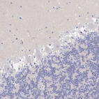 Immunohistochemical staining of human cerebellum shows no positivity in Purkinje cells as expected.