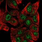 Anti-ZNF517 Antibody