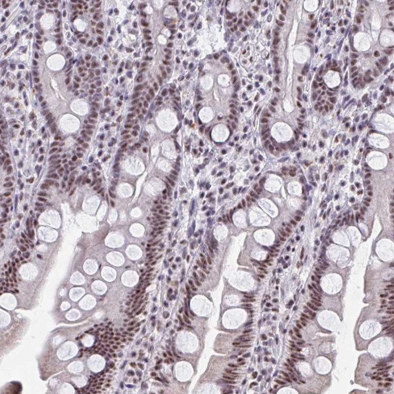 Anti-DDX39B Antibody