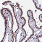 Immunohistochemical staining of human fallopian tube shows strong nuclear positivity in glandular cells.