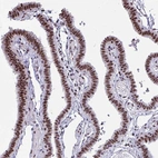 Immunohistochemical staining of human fallopian tube shows strong nuclear positivity in glandular cells.