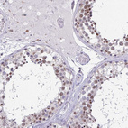 Immunohistochemical staining of human testis shows moderate nuclear positivity in cells in seminiferous ducts.