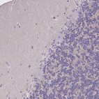 Immunohistochemical staining of human cerebellum shows no nuclear positivity in Purkinje cells as expected.