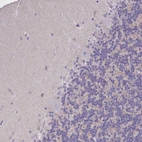 Immunohistochemical staining of human cerebellum shows no nuclear positivity in Purkinje cells as expected.