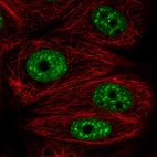Immunofluorescent staining of human cell line MCF7 shows localization to nuclear speckles.