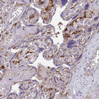 Anti-TNS3 Antibody