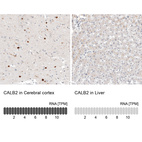 Anti-CALB2 Antibody