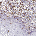 Immunohistochemical staining of human cervix, uterine shows moderate to strong cytoplasmic positivity in macrophages.