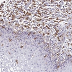 Immunohistochemical staining of human cervix, uterine shows moderate to strong cytoplasmic positivity in macrophages.