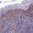 Immunohistochemical staining of human lymph node shows moderate to strong cytoplasmic positivity in macrophages.