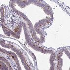 Immunohistochemical staining of human fallopian tube shows moderate to strong cytoplasmic positivity in glandular cells.