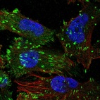 Immunofluorescent staining of human cell line U-251 MG shows localization to focal adhesion sites.