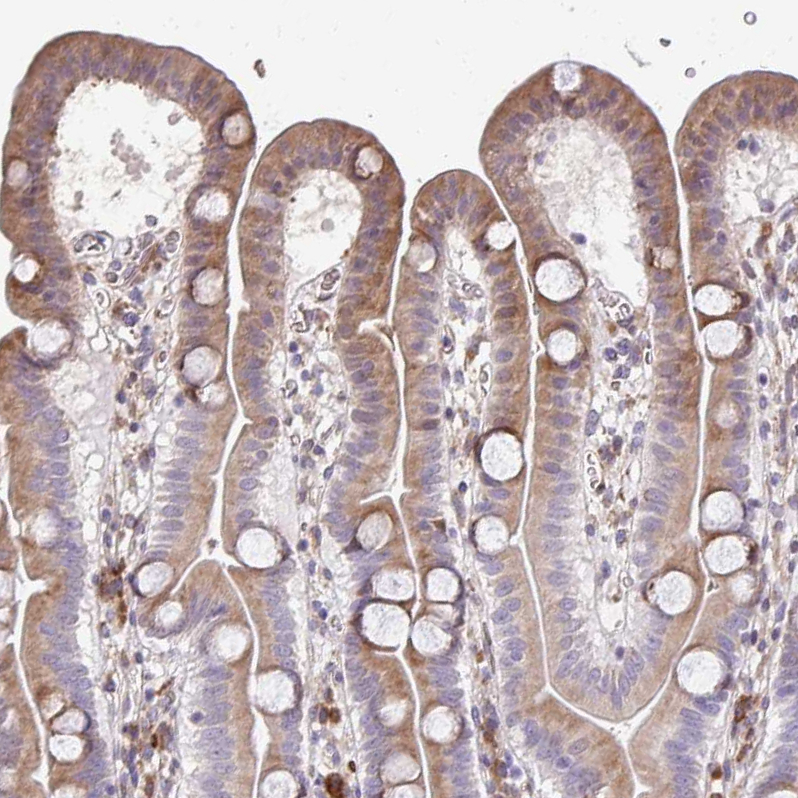 Anti-FIBCD1 Antibody