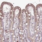 Anti-FIBCD1 Antibody