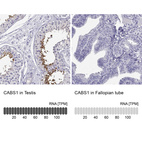 Anti-CABS1 Antibody