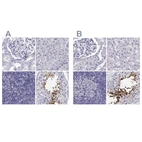 Immunohistochemical staining of human kidney, liver, lymph node and testis using Anti-CABS1 antibody HPA055352 (A) shows similar protein distribution across tissues to independent antibody HPA044016 (B).